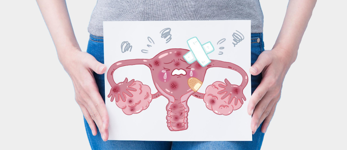 Μετεμμηνοπαυσιακή αιμορραγία