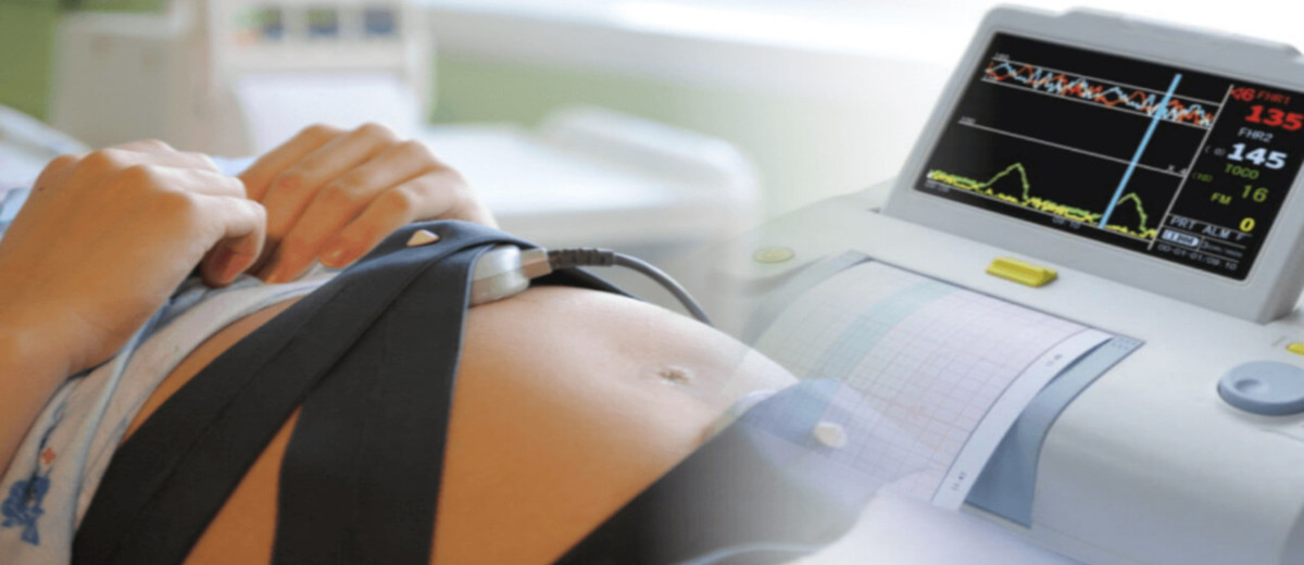 Εμβρυϊκή αρρυθμία