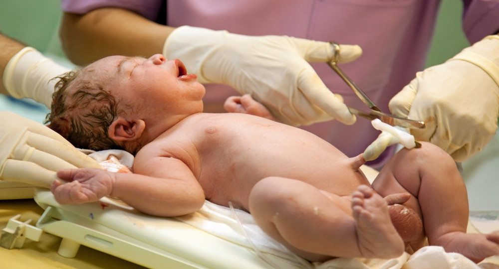 Νεογέννητο Νεογέννητο