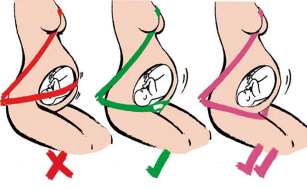 Ζώνη ασφαλείας στην εγκυμοσύνη Ζώνη ασφαλείας στην εγκυμοσύνη